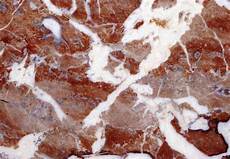 Marble Decoration